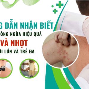 Hướng dẫn nhận biết, xử lý, phòng ngừa hiệu quả chốc và nhọt cho người lớn và trẻ em